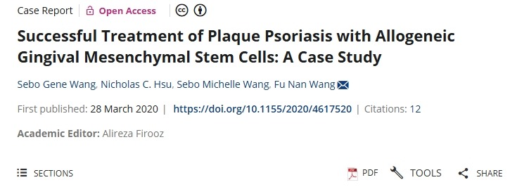 用同種異體牙齦間充質干細胞成功治療斑塊狀銀屑病:案例研究 用同種異體牙齦間充質干細胞成功治療斑塊狀銀屑病:案例研究