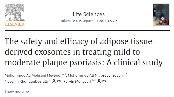 脂肪組織衍生外泌體治療輕中度斑塊狀銀屑病的安全性和有效性:一項(xiàng)臨床研究 脂肪組織衍生外泌體治療輕中度斑塊狀銀屑病的安全性和有效性:一項(xiàng)臨床研究