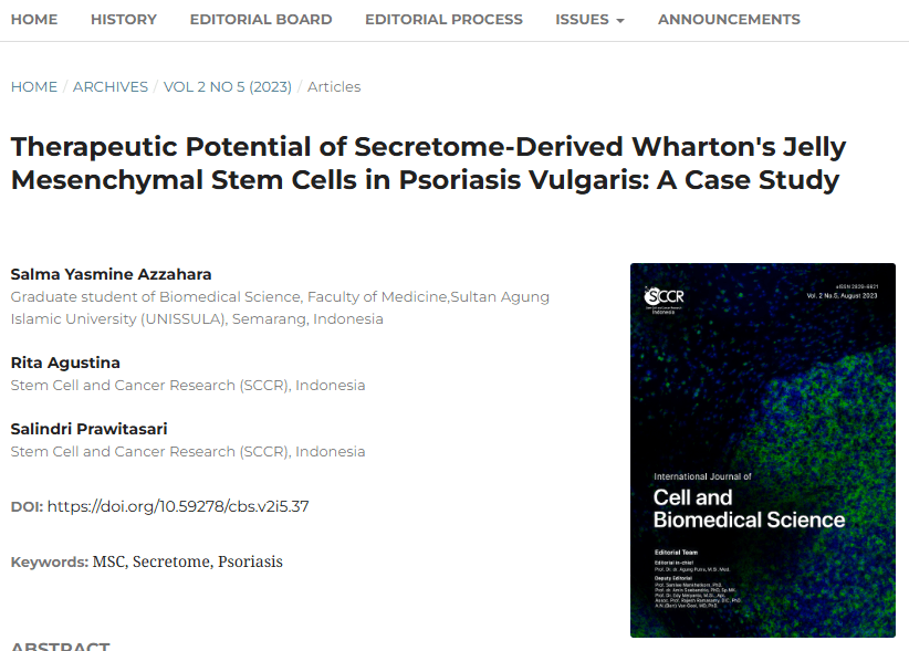 《分泌組衍生的華通氏膠間充質(zhì)干細(xì)胞在尋常型銀屑病中的治療潛力:案例研究》 《分泌組衍生的華通氏膠間充質(zhì)干細(xì)胞在尋常型銀屑病中的治療潛力:案例研究》