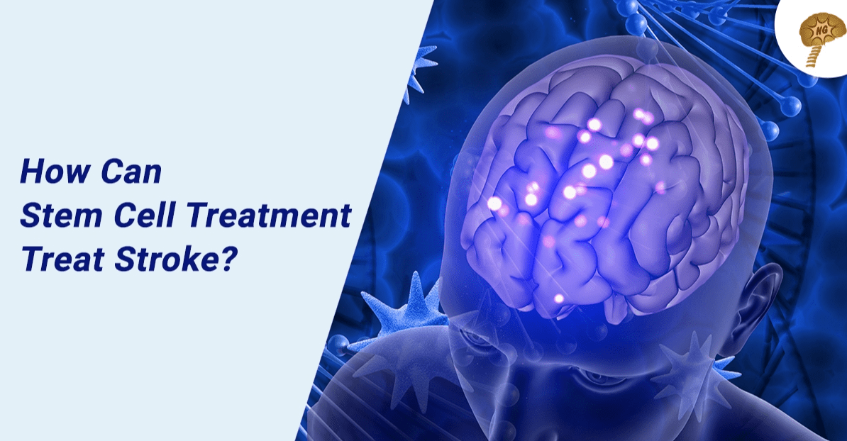 急性缺血性腦卒中——全球健康的沉重負擔 急性缺血性腦卒中——全球健康的沉重負擔