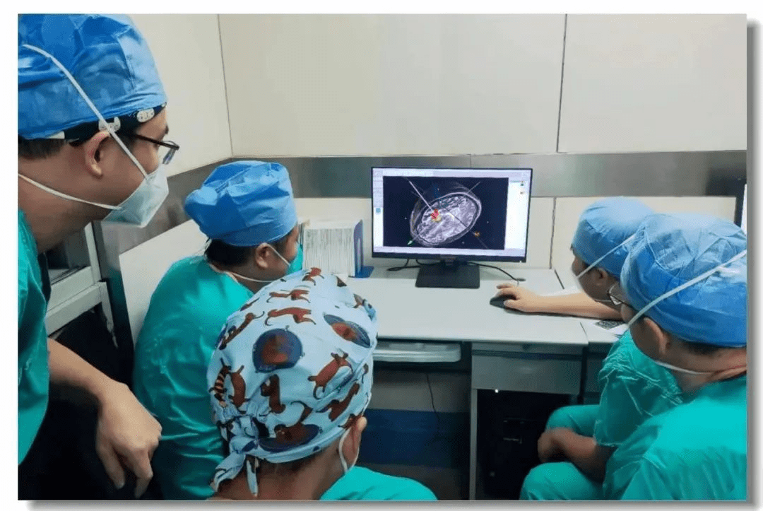 立體定向引導(dǎo)下神經(jīng)干細(xì)胞移植術(shù) 立體定向引導(dǎo)下神經(jīng)干細(xì)胞移植術(shù)