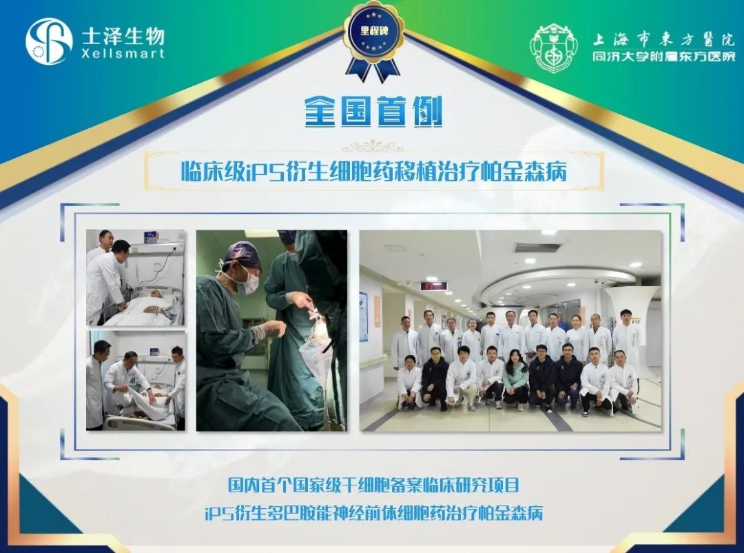 臨床級(jí)iPSC衍生多巴胺能神經(jīng)前體細(xì)胞治療中重度帕金森病 臨床級(jí)iPSC衍生多巴胺能神經(jīng)前體細(xì)胞治療中重度帕金森病