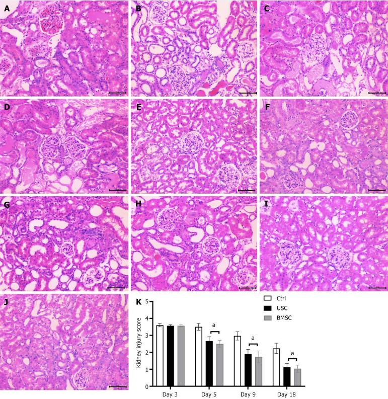 圖4：通過蘇木精和伊紅染色（200 ×）對尿液來源的干細胞治療、骨髓間充質干細胞治療和對照未治療小鼠的急性腎損傷進行組織學檢查。