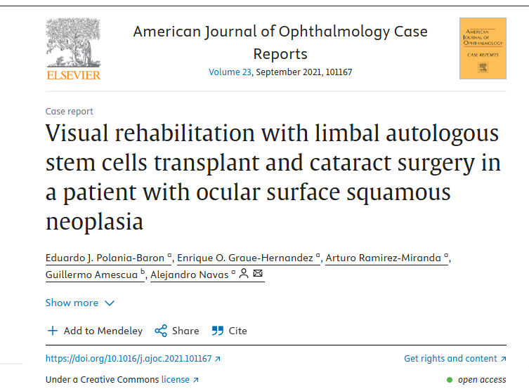 眼表鱗狀細胞瘤患者角膜緣自體干細胞移植及白內(nèi)障手術進行視力康復