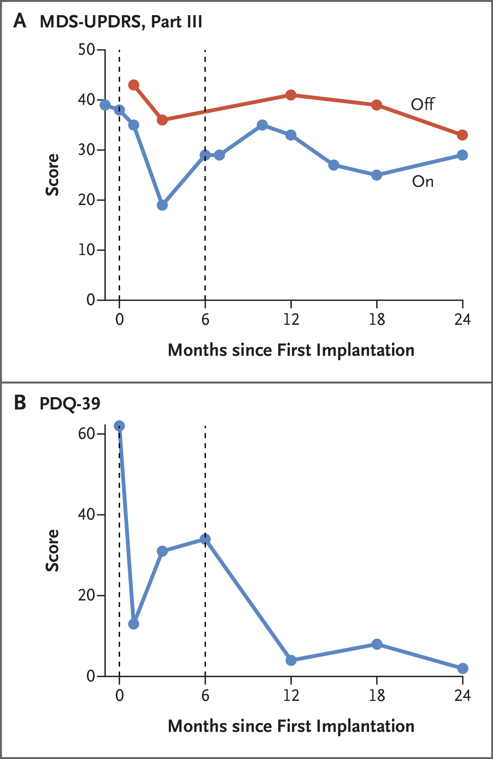 帕金森病相關運動功能和生活質量的縱向臨床評估 帕金森病相關運動功能和生活質量的縱向臨床評估