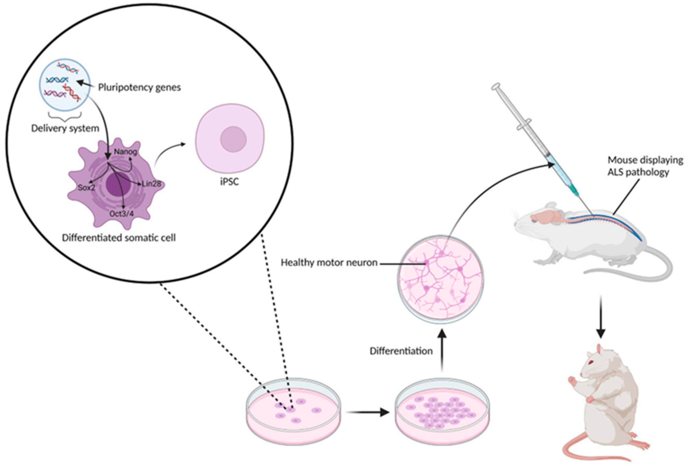 圖4:涉及移植iPSC衍生NSC的典型臨床前實驗方案 圖4:涉及移植iPSC衍生NSC的典型臨床前實驗方案