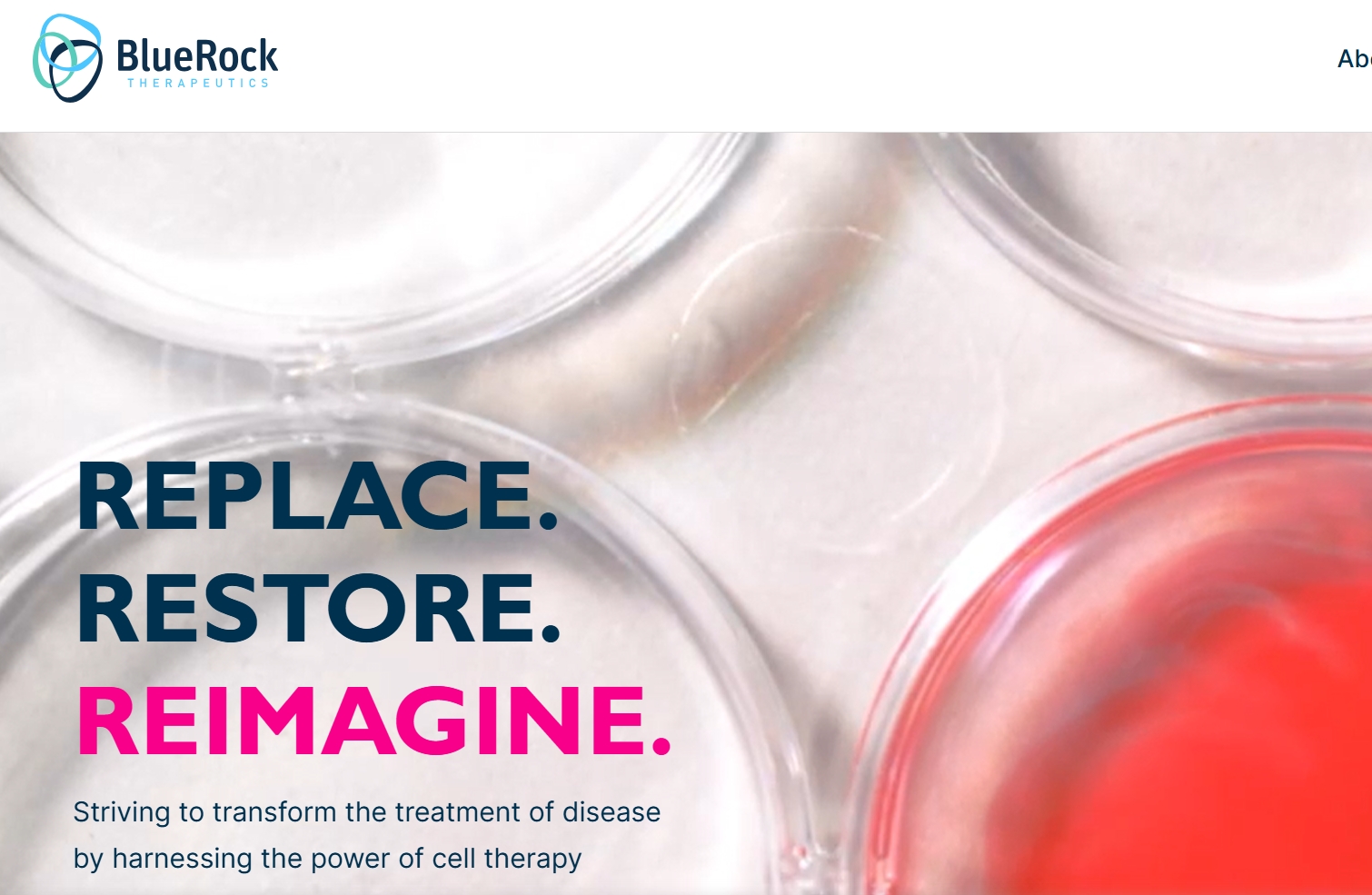 拜耳突破性干細胞治療帕金森病III期臨床試驗啟動，開啟治療新紀元！