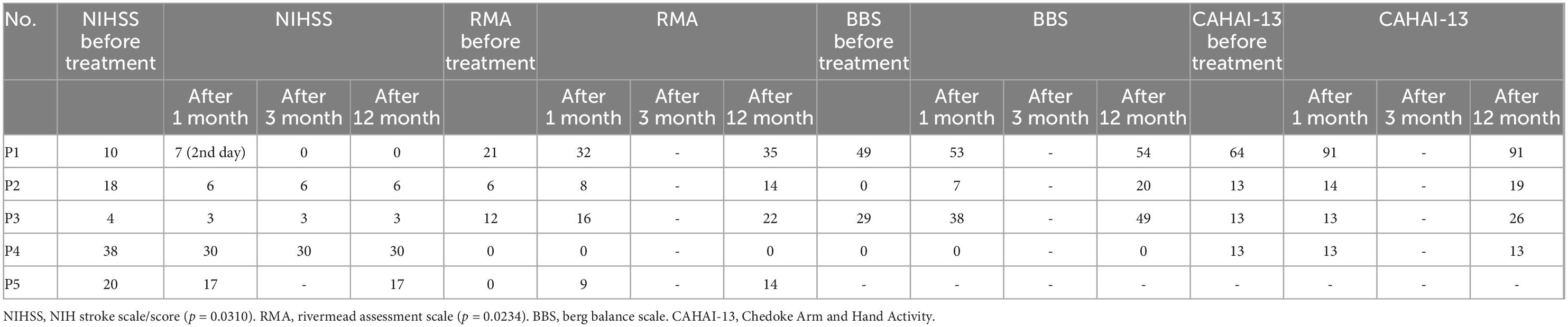 臍帶間充質(zhì)干細(xì)胞 (UC-MSC) 治療后中風(fēng)康復(fù)的結(jié)果測(cè)量 臍帶間充質(zhì)干細(xì)胞 (UC-MSC) 治療后中風(fēng)康復(fù)的結(jié)果測(cè)量