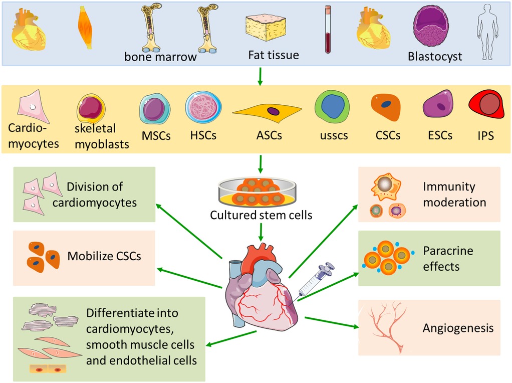 圖1:心肌梗死中的干細(xì)胞療法示意圖。 圖1:心肌梗死中的干細(xì)胞療法示意圖。