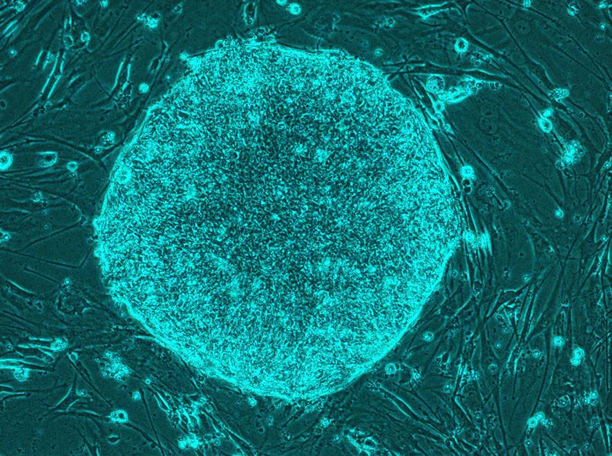 iPS細(xì)胞 iPS細(xì)胞