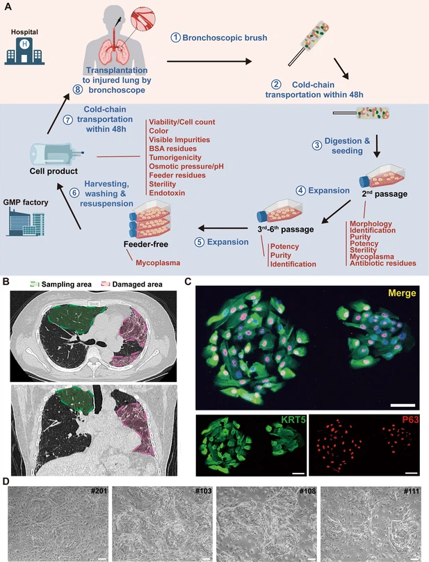 圖1：從IPF患者中分離的P63+肺祖細胞的克隆和表征。