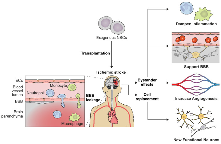 圖2:NSC輸送示意圖,說(shuō)明缺血性中風(fēng)的多種治療機(jī)制。 圖2:NSC輸送示意圖,說(shuō)明缺血性中風(fēng)的多種治療機(jī)制。