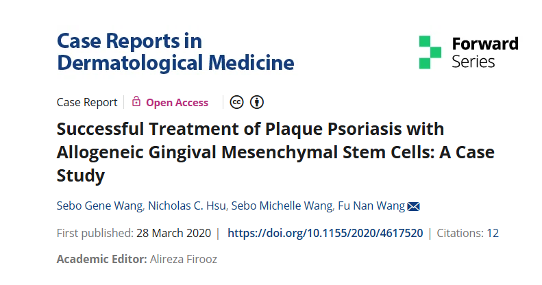 同種異體牙齦間充質干細胞成功治療斑塊性銀屑?。喊咐芯? class=