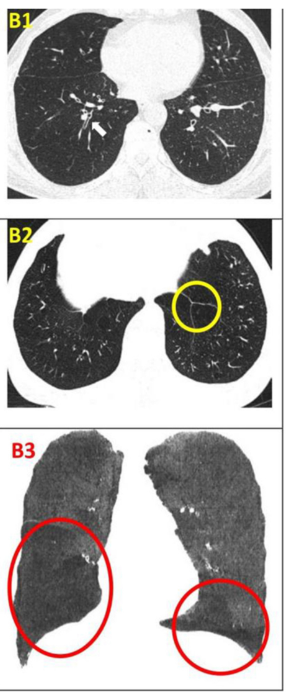影像學檢查 影像學檢查