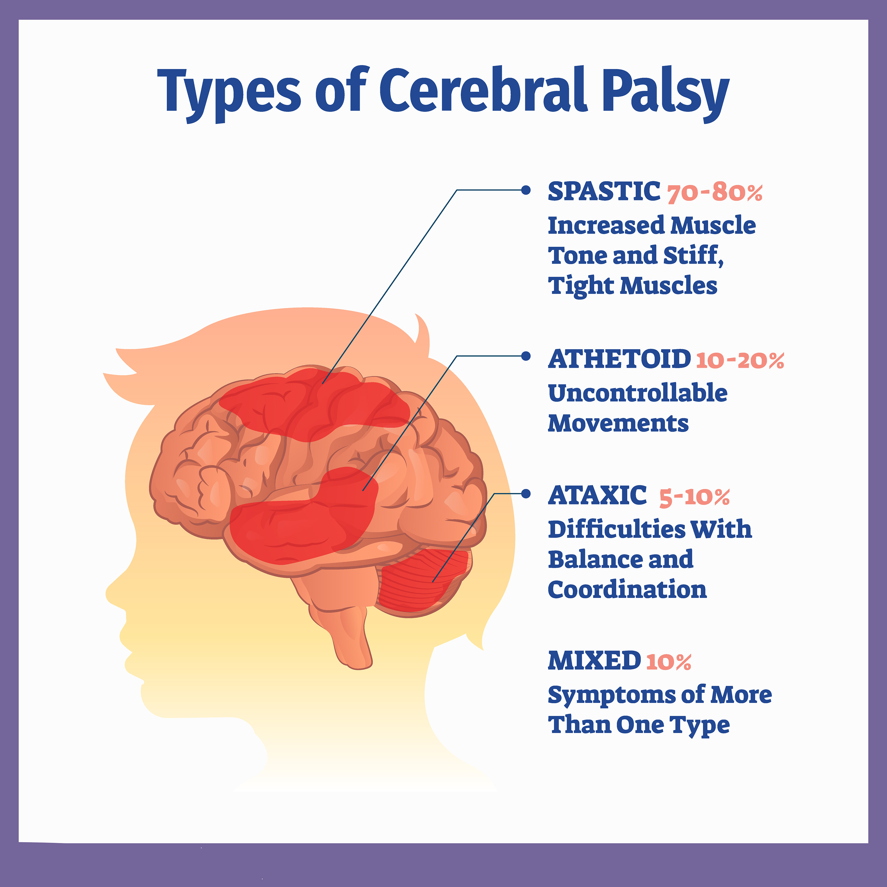 低劑量VS高劑量:不同劑量的干細胞治療腦癱哪個更加安全? 低劑量VS高劑量:不同劑量的干細胞治療腦癱哪個更加安全?
