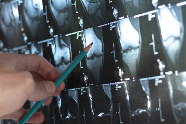 4種細(xì)胞療法運(yùn)用免疫調(diào)節(jié)和再生機(jī)制為治療骨科疾病開(kāi)辟了新方向 4種細(xì)胞療法運(yùn)用免疫調(diào)節(jié)和再生機(jī)制為治療骨科疾病開(kāi)辟了新方向