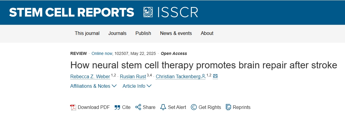 神經(jīng)干細(xì)胞療法如何促進(jìn)中風(fēng)后的大腦修復(fù) 神經(jīng)干細(xì)胞療法如何促進(jìn)中風(fēng)后的大腦修復(fù)