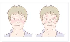 2025年1-10月干細(xì)胞治療系統(tǒng)性紅斑狼瘡匯總:多項(xiàng)臨床試驗(yàn)全面提速! 2025年1-10月干細(xì)胞治療系統(tǒng)性紅斑狼瘡匯總:多項(xiàng)臨床試驗(yàn)全面提速!