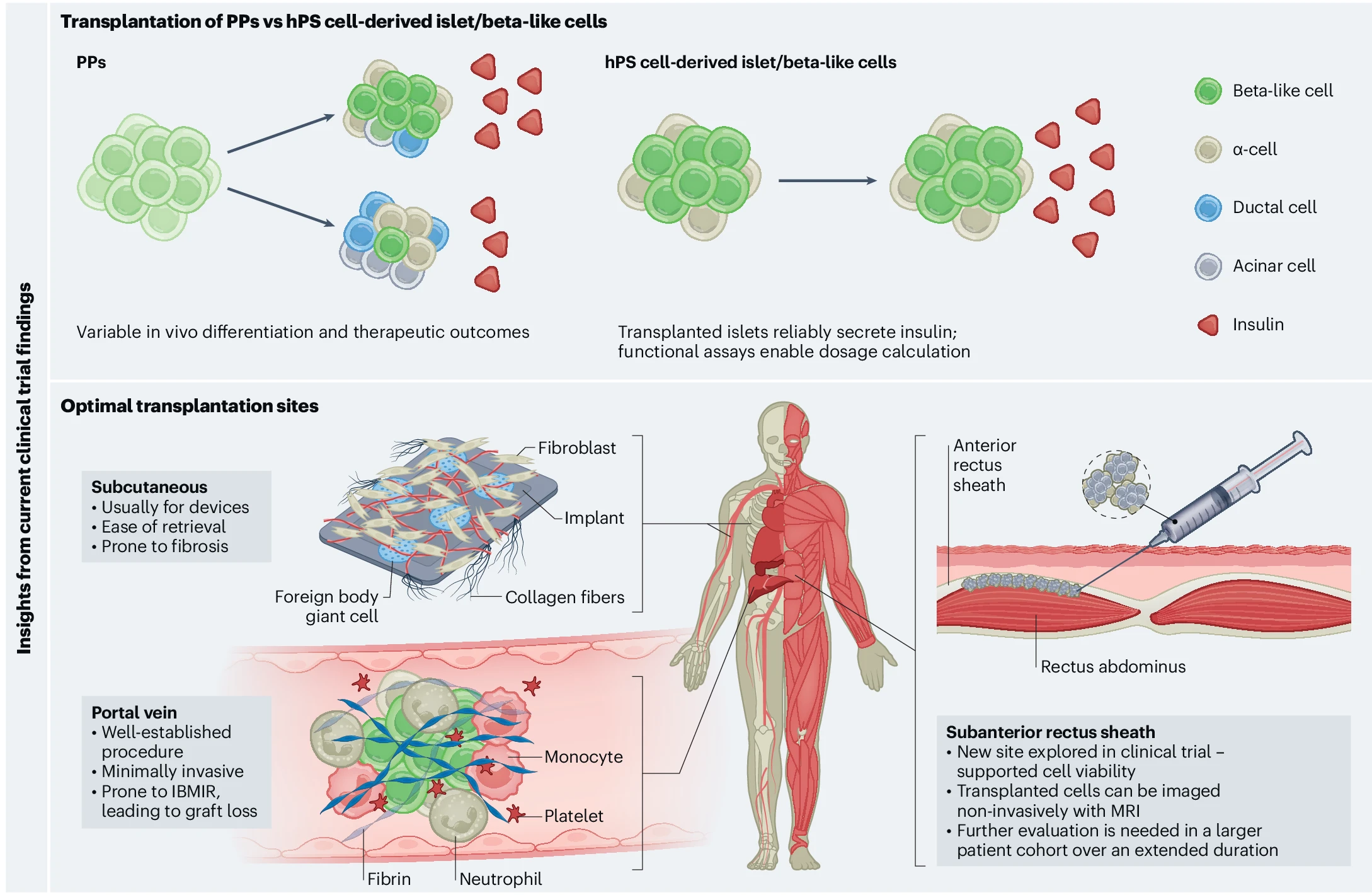圖2：最新干細胞治療糖尿病的創(chuàng)新和經(jīng)驗教訓