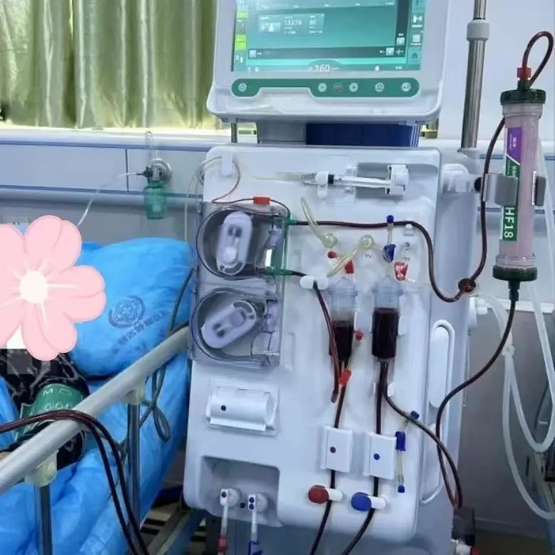 單針交互透析技術(shù) 單針交互透析技術(shù)