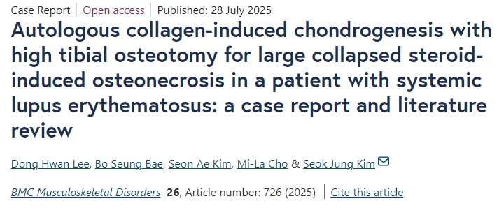 自體膠原誘導(dǎo)軟骨形成聯(lián)合脛骨高位截骨術(shù)治療系統(tǒng)性紅斑狼瘡患者大面積塌陷性類固醇性骨壞死：病例報(bào)告及文獻(xiàn)綜述