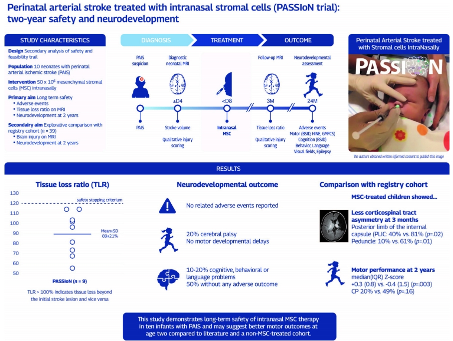 經鼻給藥干細胞療法突破：新生兒卒中后腦癱風險直降50%！2年安全追蹤