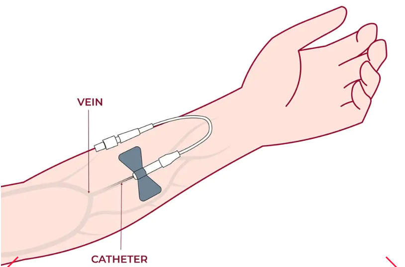 細胞通過靜脈輸注進行給藥，在某些情況下，可以使用其他輸送方法（例如鼻噴霧劑或局部應用）來針對特定系統。
