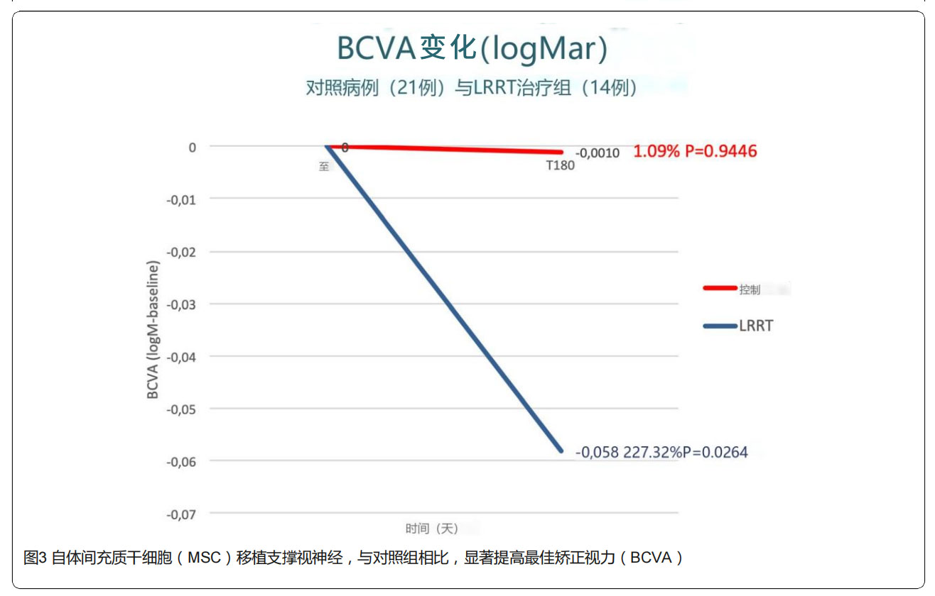 青光眼臨床試驗(yàn) 青光眼臨床試驗(yàn)