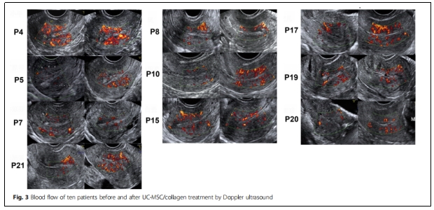 臨床試驗(yàn) 臨床試驗(yàn)