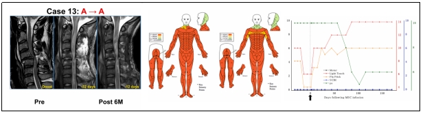 臨床試驗 臨床試驗
