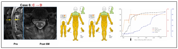 臨床試驗 臨床試驗