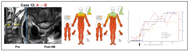 臨床試驗 臨床試驗