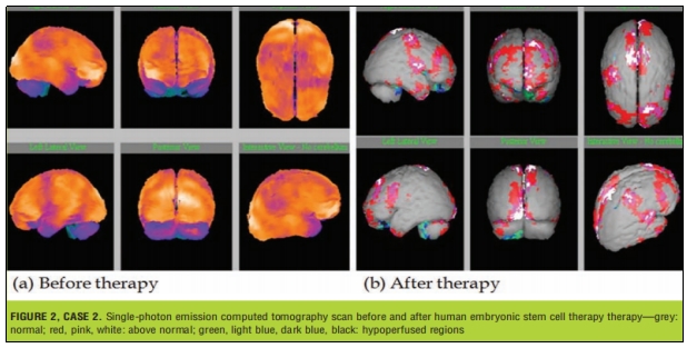 臨床試驗 臨床試驗