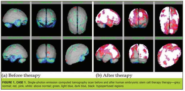 臨床試驗 臨床試驗