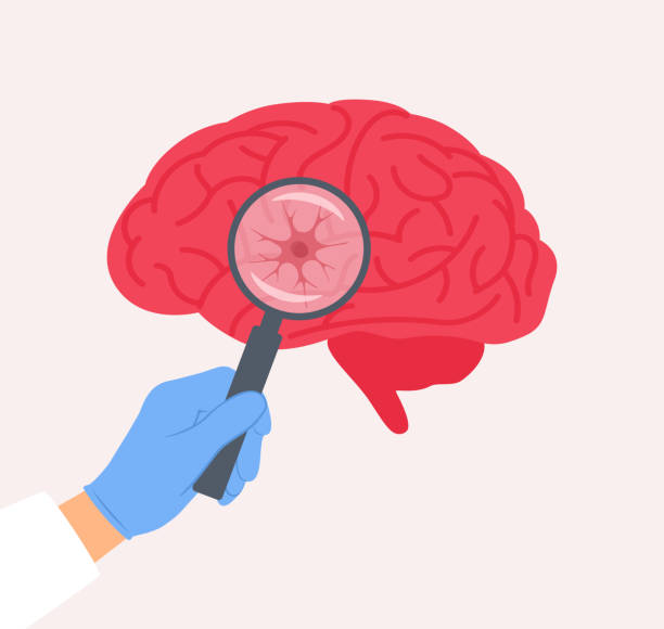 干細胞療法vs深部腦刺激:帕金森病進階治療方案療效對比 干細胞療法vs深部腦刺激:帕金森病進階治療方案療效對比