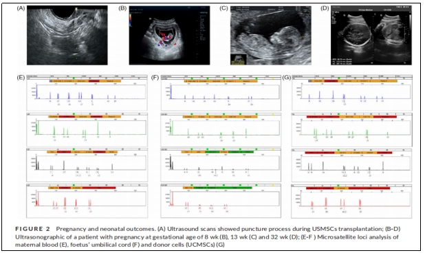 圖2：妊娠和新生兒結果。