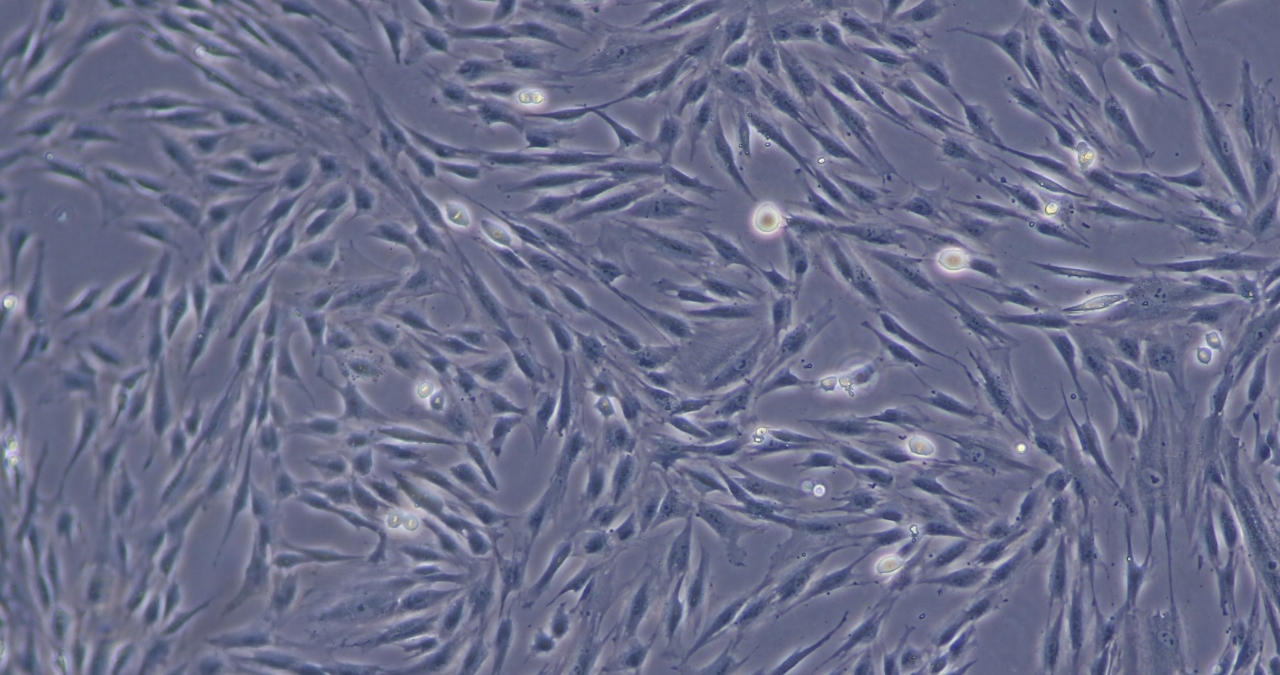 間充質干細胞 間充質干細胞