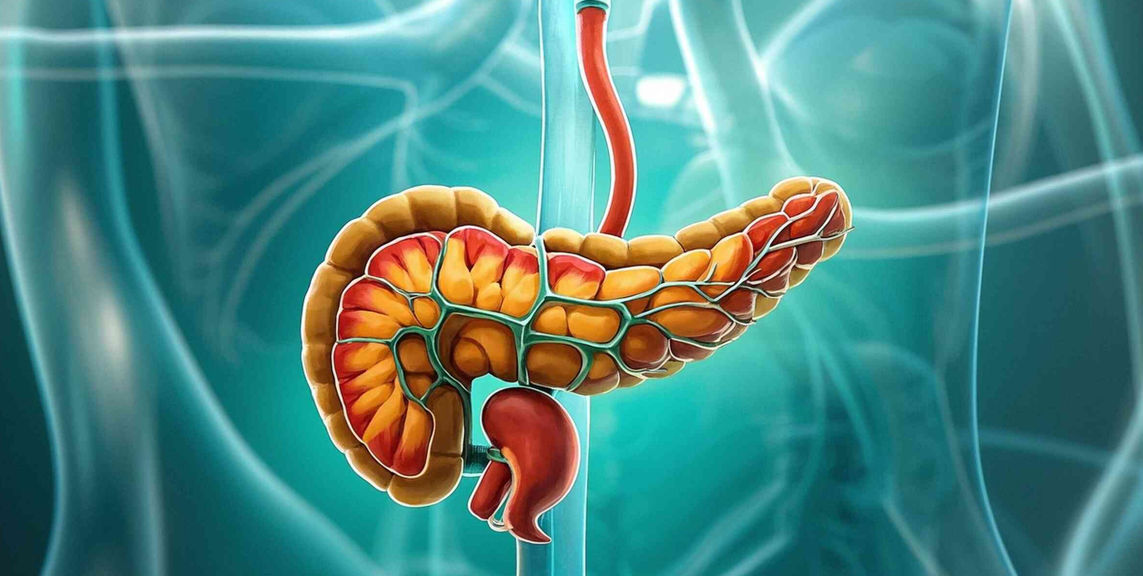 系統(tǒng)性保護(hù)!間充質(zhì)干細(xì)胞療法為重癥胰腺炎帶來(lái)新曙光 系統(tǒng)性保護(hù)!間充質(zhì)干細(xì)胞療法為重癥胰腺炎帶來(lái)新曙光