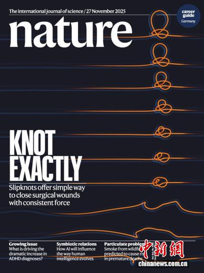 研究成果發表于國際頂級期刊《自然》并登上雜志封面。研究團隊供圖 研究成果發表于國際頂級期刊《自然》并登上雜志封面。研究團隊供圖